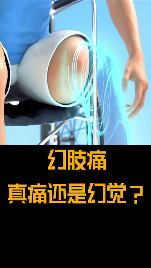 幻肢痛的脑区重塑干预（幻肢痛觉）