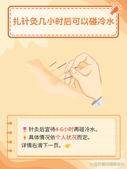 中医养生针灸如何缓解疼痛(中医针灸治疗疼痛)