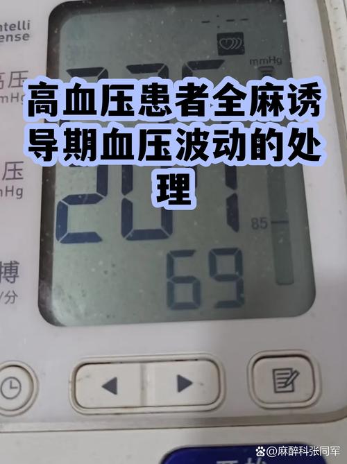 数据监控指标正常波动范围的确定（数据监控的指标包含有哪些）